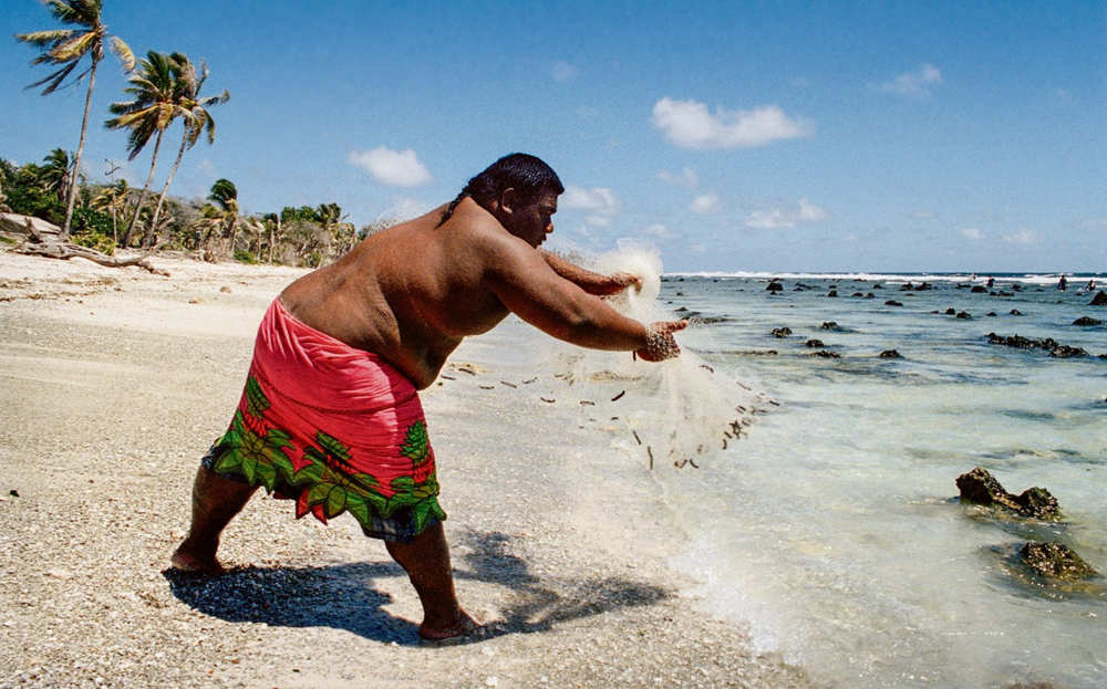 So Small, Yet So So Big: Nauru’s Obesity Epidemic